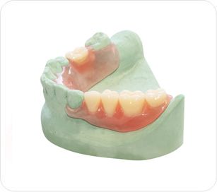 Prothèse Valplast