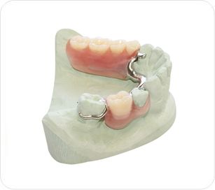 Stellite Finition Valplast