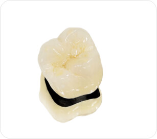 Couronne Céramique Non Précieux