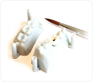 Couronne Céramique sur Implants Transvissée