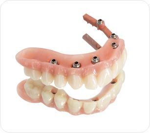 Prothèse Résine sur Implant Transvissée